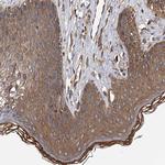 EXOC4 Antibody in Immunohistochemistry (Paraffin) (IHC (P))