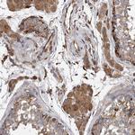 EXOC4 Antibody in Immunohistochemistry (Paraffin) (IHC (P))