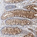 HLA-E Antibody in Immunohistochemistry (Paraffin) (IHC (P))