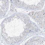 HLA-E Antibody in Immunohistochemistry (Paraffin) (IHC (P))