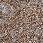 HLA-E Antibody in Immunohistochemistry (IHC)