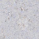 HLA-E Antibody in Immunohistochemistry (IHC)