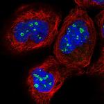 PELO Antibody in Immunocytochemistry (ICC/IF)