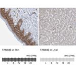 FAM83B Antibody in Immunohistochemistry (IHC)