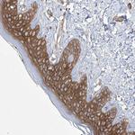 FAM83B Antibody in Immunohistochemistry (IHC)