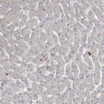 FAM83B Antibody in Immunohistochemistry (IHC)