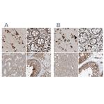 XTP3B Antibody in Immunohistochemistry (IHC)