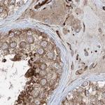 XTP3B Antibody in Immunohistochemistry (IHC)