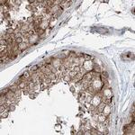 XTP3B Antibody in Immunohistochemistry (IHC)