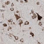 XTP3B Antibody in Immunohistochemistry (IHC)