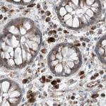 XTP3B Antibody in Immunohistochemistry (IHC)