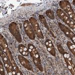 GMDS Antibody in Immunohistochemistry (IHC)