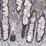 KIAA1429 Antibody in Immunohistochemistry (Paraffin) (IHC (P))