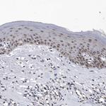 KIAA1429 Antibody in Immunohistochemistry (Paraffin) (IHC (P))