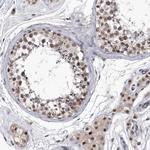 KIAA1429 Antibody in Immunohistochemistry (Paraffin) (IHC (P))