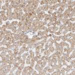 MTX2 Antibody in Immunohistochemistry (Paraffin) (IHC (P))