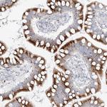 MTX2 Antibody in Immunohistochemistry (Paraffin) (IHC (P))