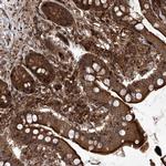 MAGED2 Antibody in Immunohistochemistry (Paraffin) (IHC (P))