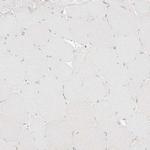 DCDC2 Antibody in Immunohistochemistry (Paraffin) (IHC (P))