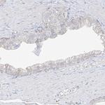 DCDC2 Antibody in Immunohistochemistry (IHC)