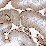 DCDC2 Antibody in Immunohistochemistry (IHC)