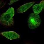 DCDC2 Antibody in Immunocytochemistry (ICC/IF)