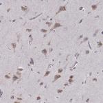 BEND6 Antibody in Immunohistochemistry (IHC)