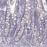 BEND6 Antibody in Immunohistochemistry (IHC)