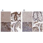 ASCC3 Antibody in Immunohistochemistry (IHC)