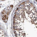 ASCC3 Antibody in Immunohistochemistry (IHC)