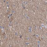 ASCC3 Antibody in Immunohistochemistry (IHC)