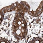 ASCC3 Antibody in Immunohistochemistry (IHC)