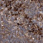 ASCC3 Antibody in Immunohistochemistry (IHC)