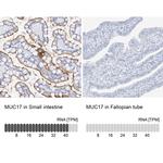 MUC17 Antibody in Immunohistochemistry (IHC)