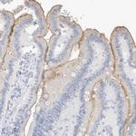 MUC17 Antibody in Immunohistochemistry (IHC)