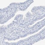 MUC17 Antibody in Immunohistochemistry (IHC)