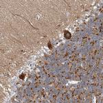 CPNE6 Antibody in Immunohistochemistry (Paraffin) (IHC (P))