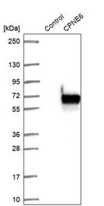 CPNE6 Antibody in Western Blot (WB)