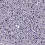 PAH Antibody in Immunohistochemistry (IHC)