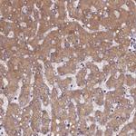 PAH Antibody in Immunohistochemistry (IHC)