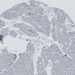 RSPH9 Antibody in Immunohistochemistry (Paraffin) (IHC (P))