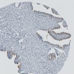 RSPH9 Antibody in Immunohistochemistry (IHC)