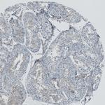 RSPH9 Antibody in Immunohistochemistry (IHC)