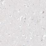 PGC Antibody in Immunohistochemistry (IHC)