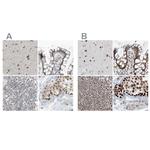 WHIP Antibody in Immunohistochemistry (IHC)