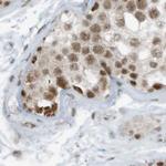 WHIP Antibody in Immunohistochemistry (IHC)