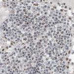 WHIP Antibody in Immunohistochemistry (IHC)