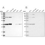 WHIP Antibody in Western Blot (WB)