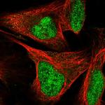 SIX4 Antibody in Immunocytochemistry (ICC/IF)