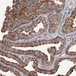 RPS25 Antibody in Immunohistochemistry (IHC)